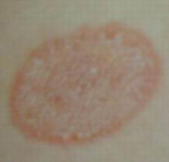 金毛犬常见皮肤病诊治