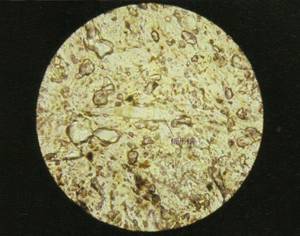 金毛犬常见皮肤病诊治